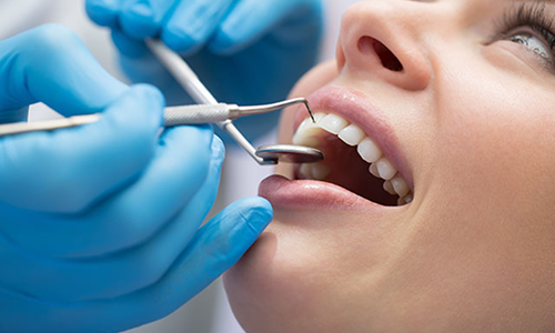 Oral Prophylaxis & Cleaning