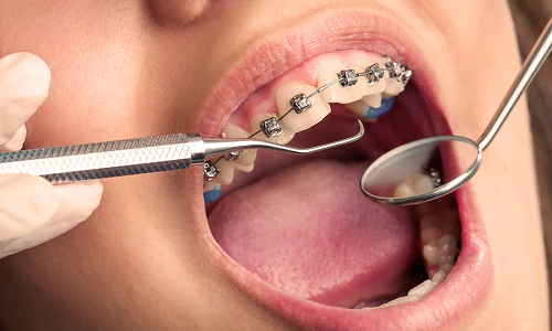 Orthodontics